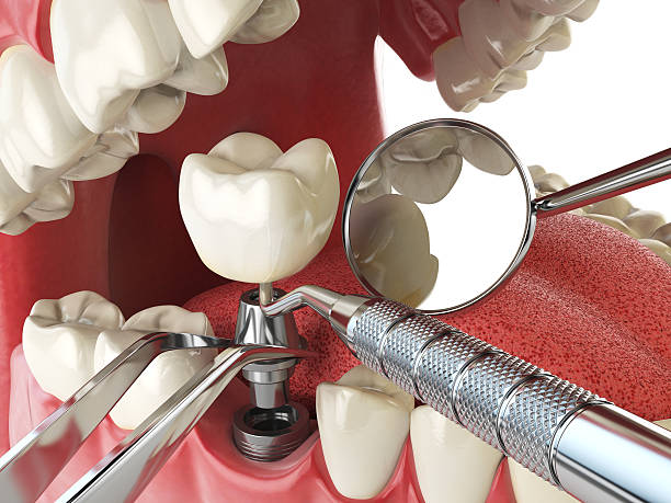 Best Emergency Treatment for Jaw Pain or Injury in Gaylord, MI